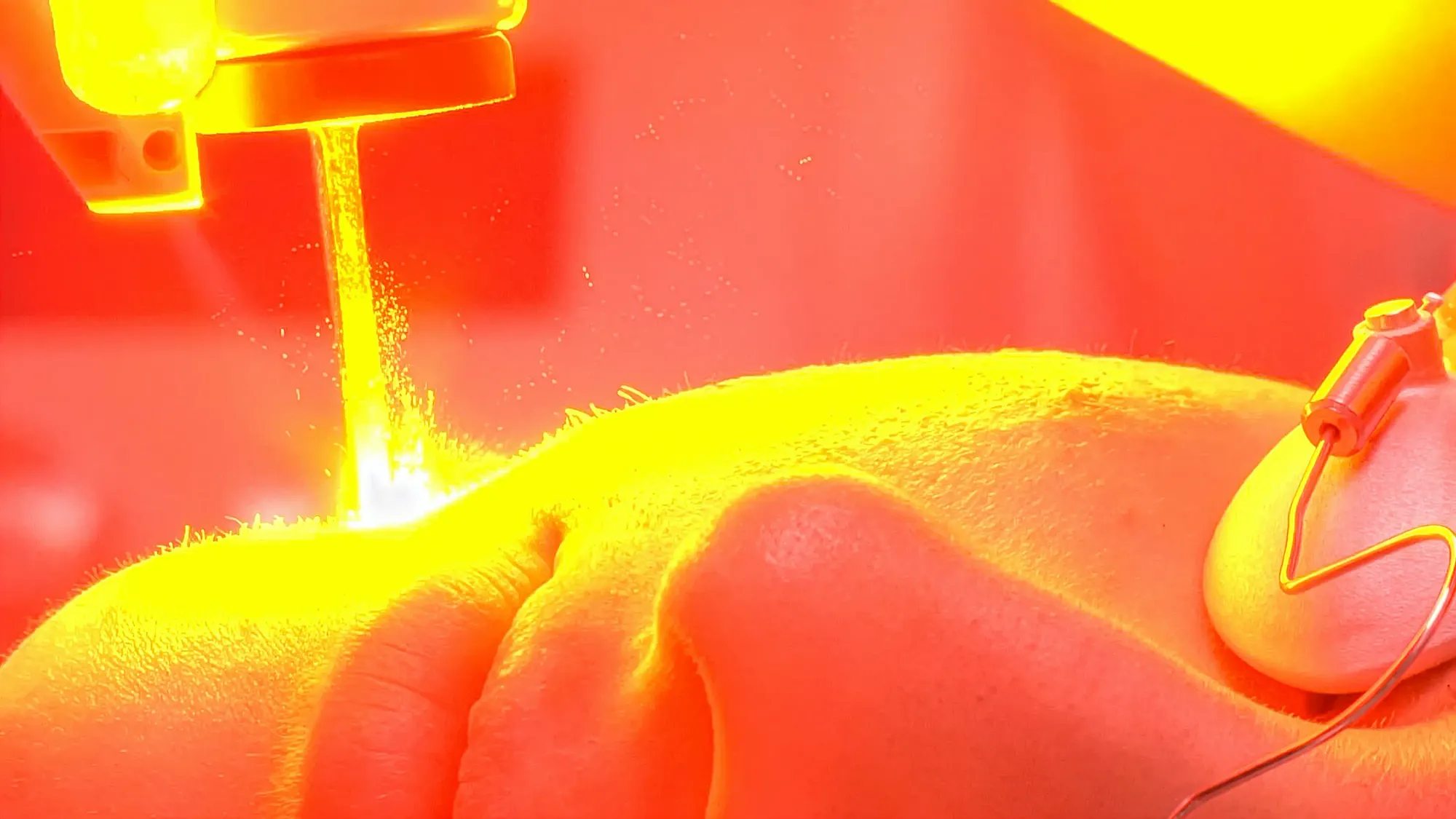 Laser Therapy: Hope or Hype and Hokum?