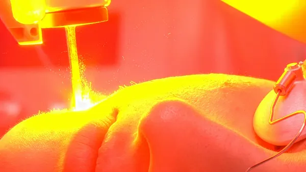 Laser Therapy: Hope or Hype and Hokum?