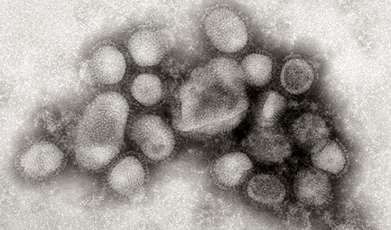 2009 H1N1 influenza