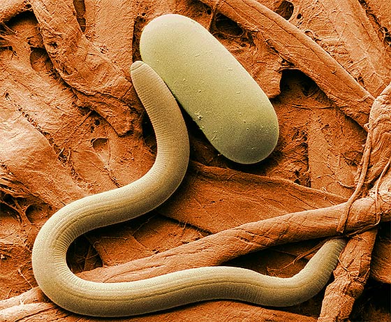 Low-temperature scanning electron micrograph of soybean cyst nematode and its egg. Magnified 1,000 times (by Agricultural Research Service [Public domain], via Wikimedia Commons) Thankfully, this little parasite doesn't infect humans.